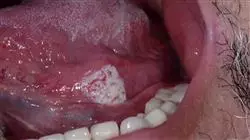 ##IMAGE##