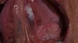 ##IMAGE##