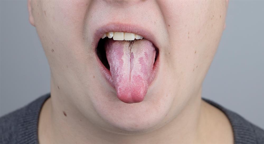 curso online experto medicina oral patologias elementales glandulas salivales atm neuropatias Tech Universidad
