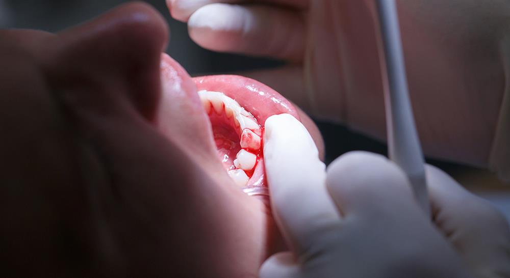 posgrado experto medicina oral patologias elementales glandulas salivales atm neuropatias Tech Universidad