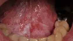 ##IMAGE##