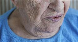 curso online experto lesiones oseas quistes tumores medicina oral Tech Universidad
