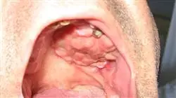 ##IMAGE##