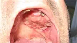 ##IMAGE##