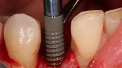 ##IMAGE##