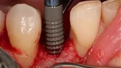 ##IMAGE##