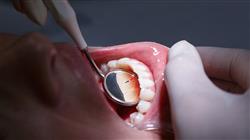 curso online neuropatias cavidad oral Tech Universidad