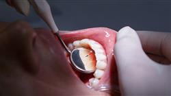curso online manejo clinico pacientes especiales patologia oral Tech Universidad