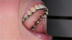 posgrado ortodoncia lingual