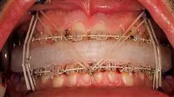 diplomado acreditado ortodoncia cirugia ortognatica