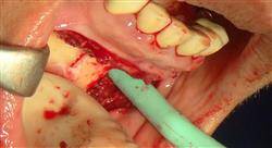 diplomado ortodoncia y cirugía ortognática