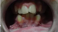 ##IMAGE##