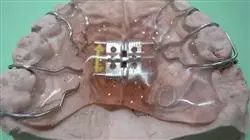##IMAGE##