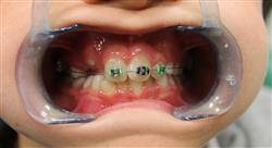 curso tratamientos avanzados en ortodoncia convencional