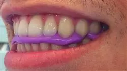 ##IMAGE##