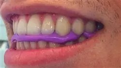 ##IMAGE##