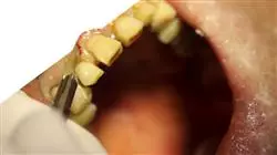 ##IMAGE##