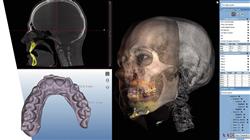 maestria implantologia cirugia oral