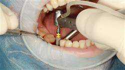 diplomado implantologia cirugia oral