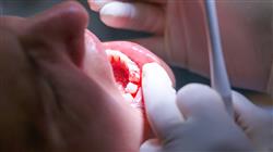 curso capacitacion practica periodoncia cirugia mucogingival