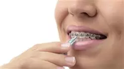 ##IMAGE##