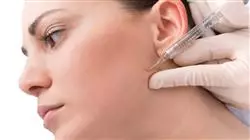 curso online rellenos dermicos acido hialuronico hidroxiapatita calcica odontologos
