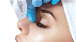 posgrado relleno dermico acido hialuronico tercio medio facial odontologos