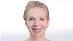##IMAGE##