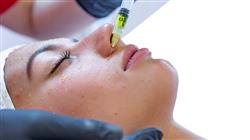 curso peeling mesoterapia facial medicina estetica armonia facial
