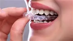 diplomado capacitacion practica odontologia estetica adhesiva