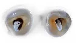 ##IMAGE##