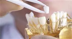 especialización rehabilitación odontológica mínimamente invasiva con porcelana