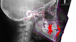 magister semipresencial ortopedia dentofacial