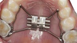 curso online capacitacion ortopedia dentofacial
