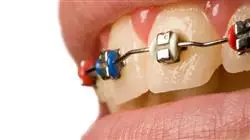 ##IMAGE##