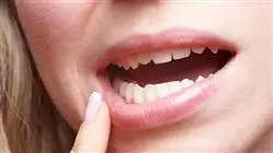 ##IMAGE##