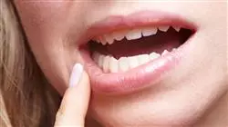 ##IMAGE##
