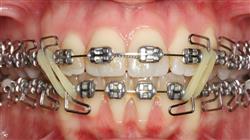 posgrado ortodoncia ortopedia tres
