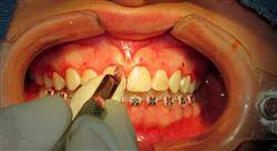 estudiar diagnóstico estético en odontología