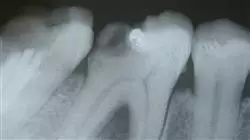 ##IMAGE##