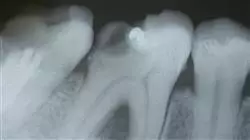 ##IMAGE##
