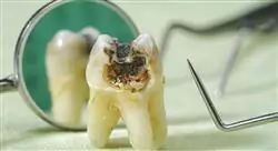 especialización retratamiento del diente endodonciado