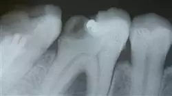 ##IMAGE##