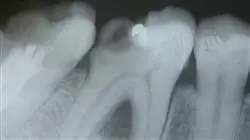 ##IMAGE##