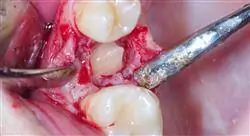 especializacion endodoncia en odontopediatría