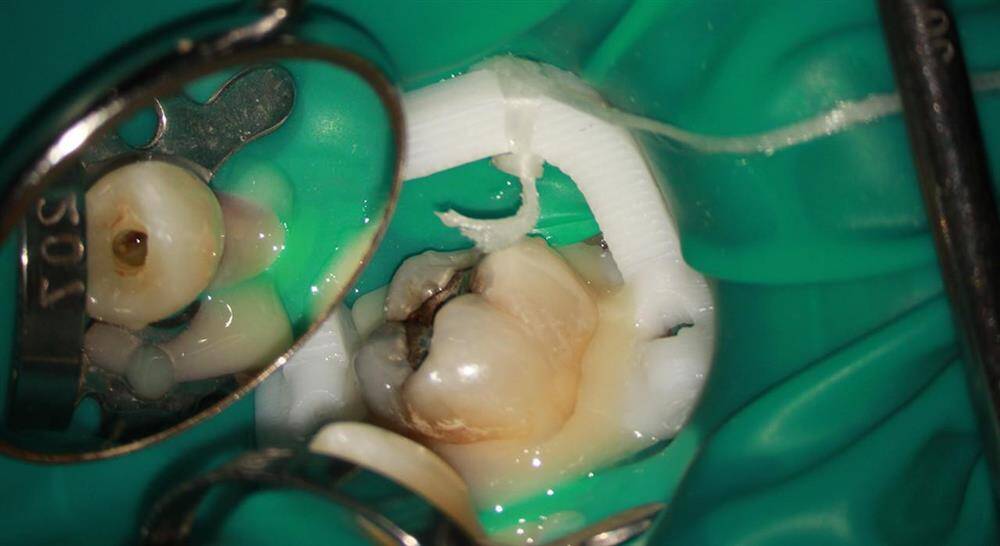 Especializaci\u00f3n en Endodoncia Quir\u00fargica - TECH Per\u00fa