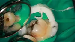 ##IMAGE##
