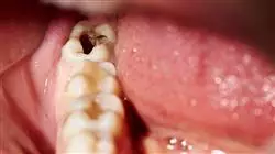 ##IMAGE##