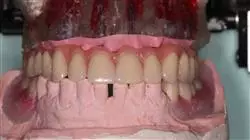 ##IMAGE##