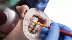 ##IMAGE##